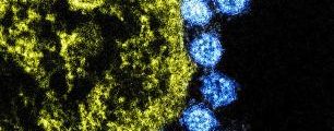 美国:NIAID讨论最近在中国出现的新型冠状病毒