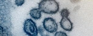 NIH/NIAID: COVID-19唤起应对新兴传染病的挑战
